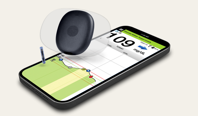 Eversense 365 - A Year-Long CGM in Europe