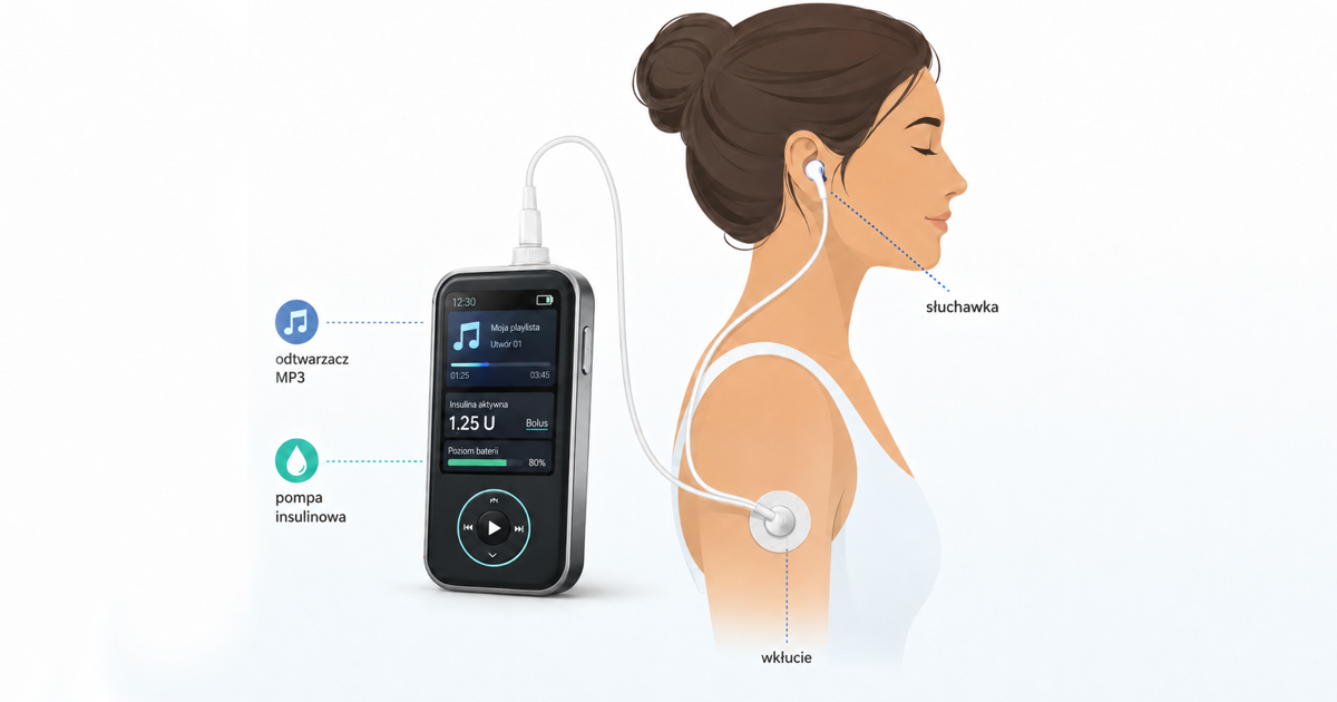 Insulinpumpe mit MP3-Player? Das seltsame Patent von Bigfoot Biomedical