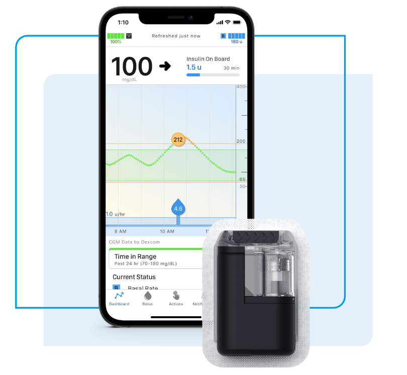 Smartfon z wykresem glikemii i danymi CGM obok czarnej pompy insulinowej na jasnym tle.